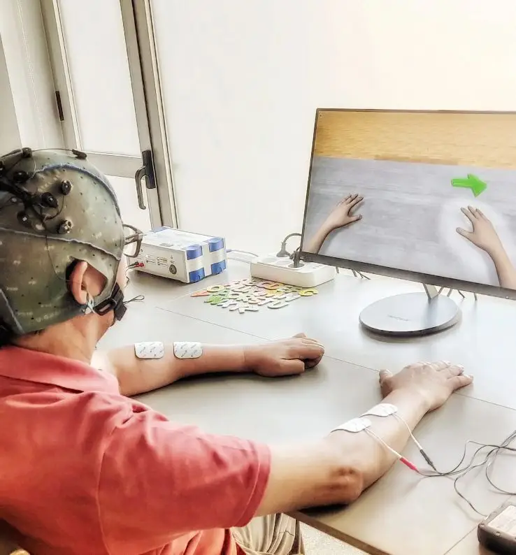 Tratamiento ictus Tecyss Elche